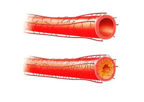 potential problems due to blood vessels